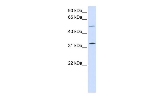 SHOX2 Antibody in Western Blot (WB)