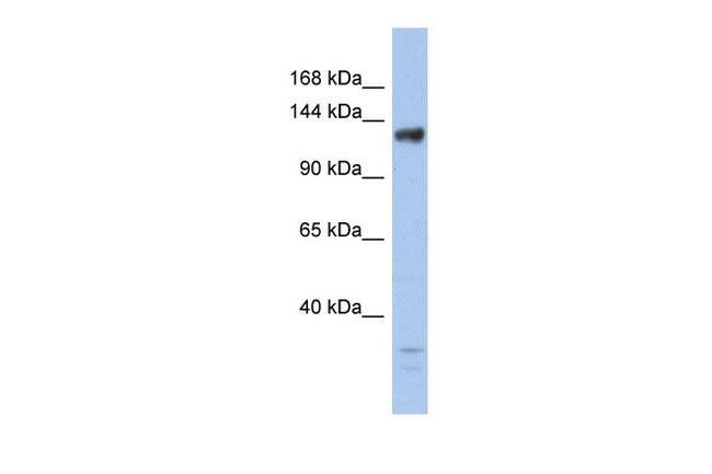 JMJD2B Antibody in Western Blot (WB)