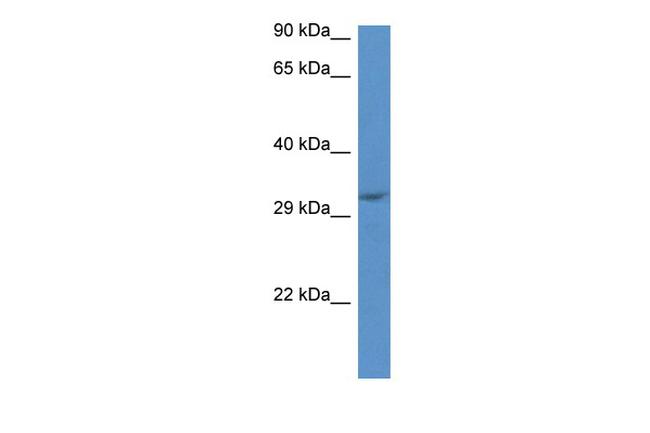 JMJD8 Antibody in Western Blot (WB)