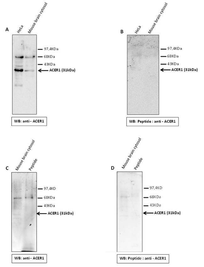 ASAH3 Antibody in Western Blot (WB)