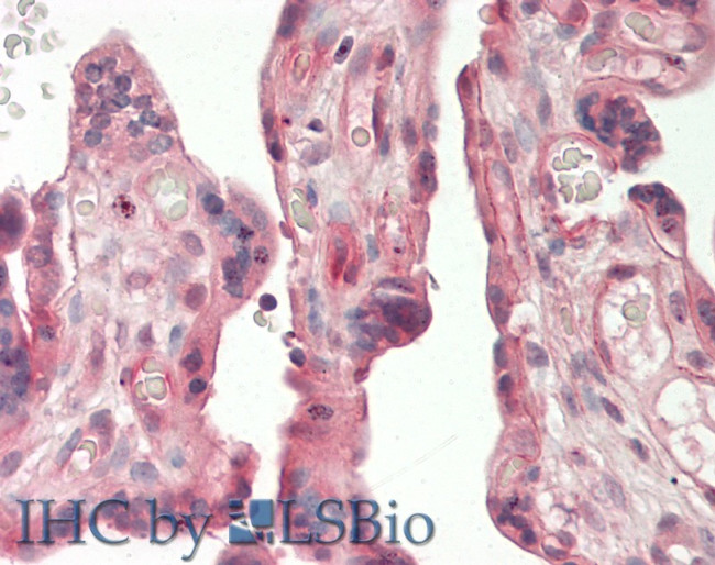 Adiponectin Receptor 2 Antibody in Immunohistochemistry (Paraffin) (IHC (P))