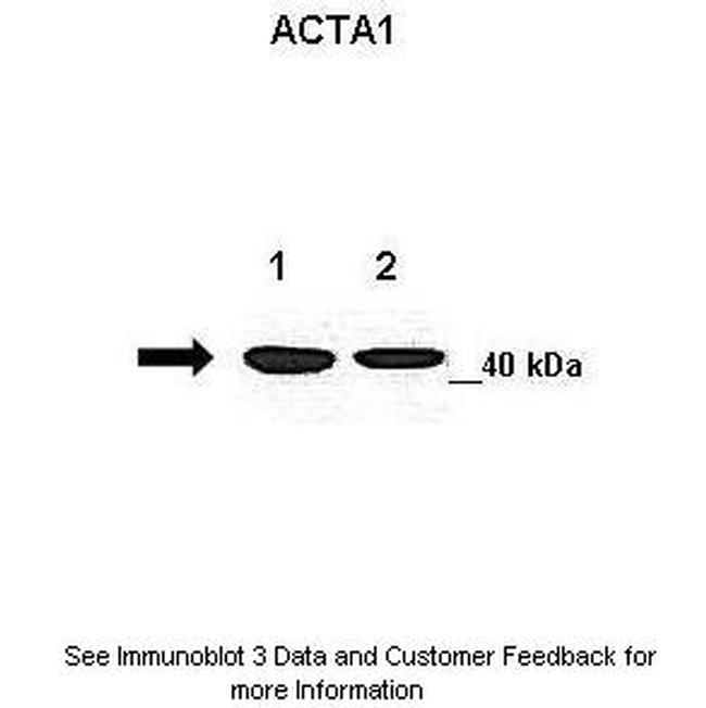 Skeletal Muscle Actin Antibody in Western Blot (WB)