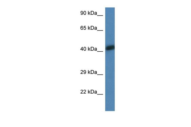 Skeletal Muscle Actin Antibody in Western Blot (WB)