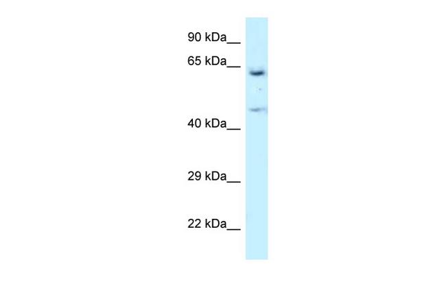 NARS Antibody in Western Blot (WB)