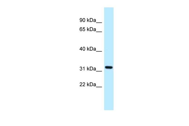 ALG5 Antibody in Western Blot (WB)