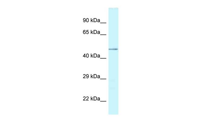 CHI3L2 Antibody in Western Blot (WB)