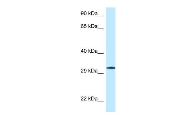 GMPR Antibody in Western Blot (WB)