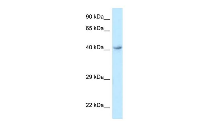 GPR120 Antibody in Western Blot (WB)