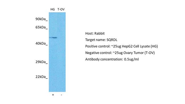 SQRDL Antibody in Western Blot (WB)