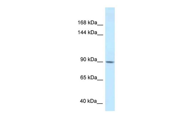 DACT1 Antibody in Western Blot (WB)