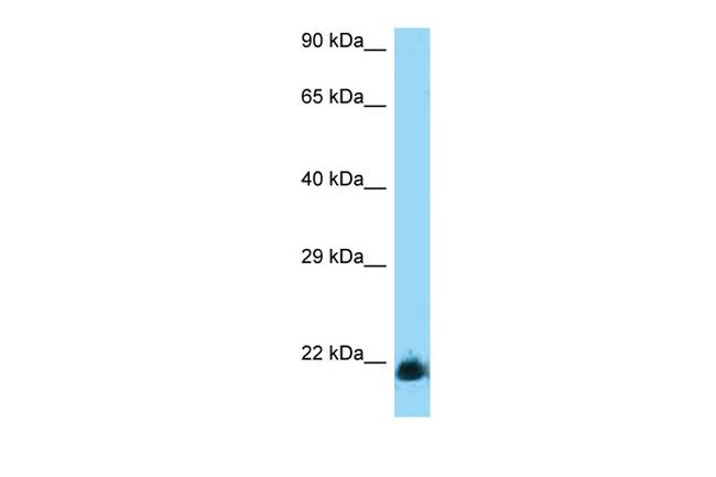 CD94 Antibody in Western Blot (WB)