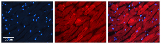 RAB11A Antibody in Immunohistochemistry (Paraffin) (IHC (P))