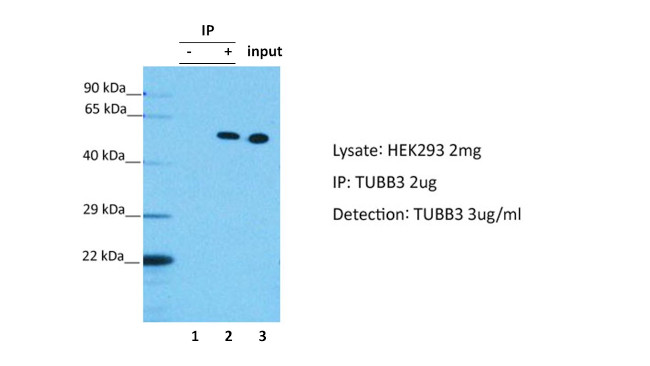 beta-3 Tubulin Antibody in Immunoprecipitation (IP)