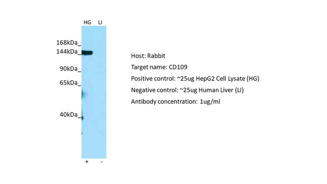 CD109 Antibody in Western Blot (WB)