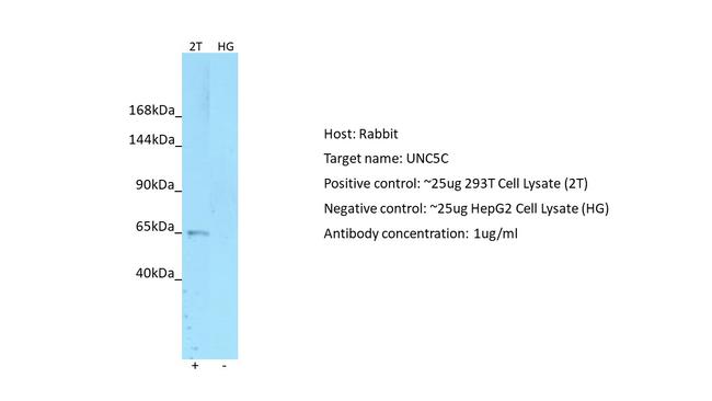 UNC5C Antibody in Western Blot (WB)