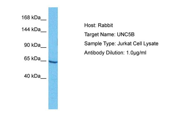 UNC5C Antibody in Western Blot (WB)