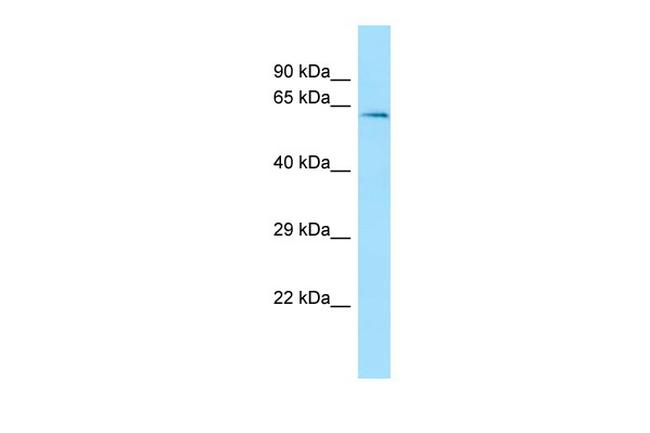 TXNRD3 Antibody in Western Blot (WB)