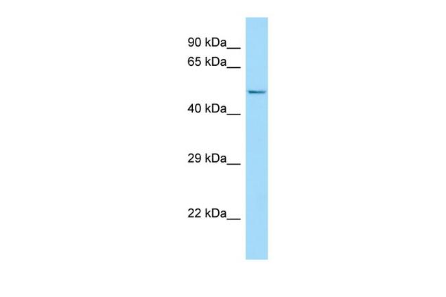 FLVCR2 Antibody in Western Blot (WB)