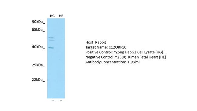 C12orf10 Antibody in Western Blot (WB)