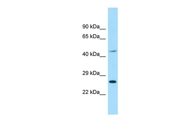 EIF4E1B Antibody in Western Blot (WB)