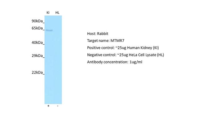 MTMR7 Antibody in Western Blot (WB)