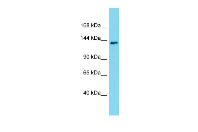 INTS2 Antibody in Western Blot (WB)