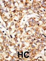 APOBEC1 Antibody in Immunohistochemistry (Paraffin) (IHC (P))