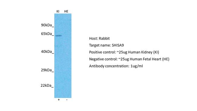 SHISA9 Antibody in Western Blot (WB)