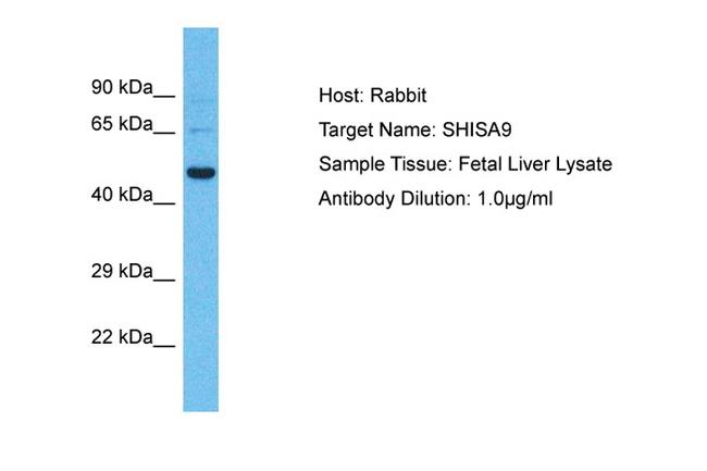 SHISA9 Antibody in Western Blot (WB)