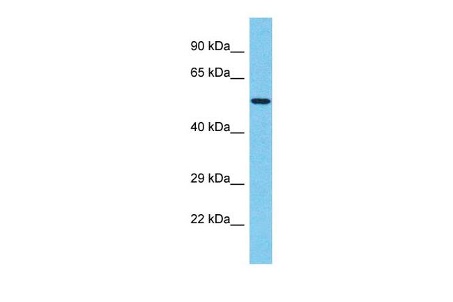 TBX20 Antibody in Western Blot (WB)