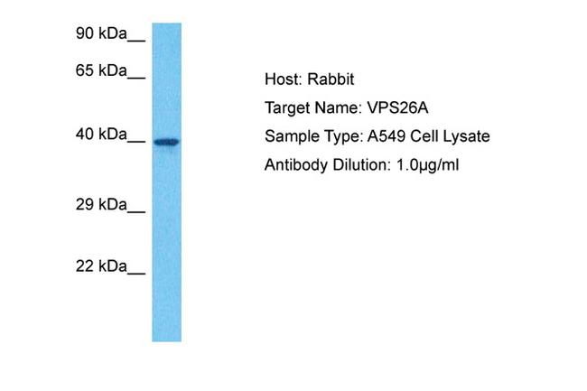 VPS26A Antibody in Western Blot (WB)