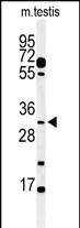 APOBEC3B Antibody in Western Blot (WB)