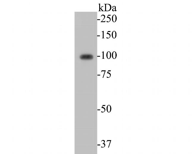 KCNB1 Antibody in Western Blot (WB)