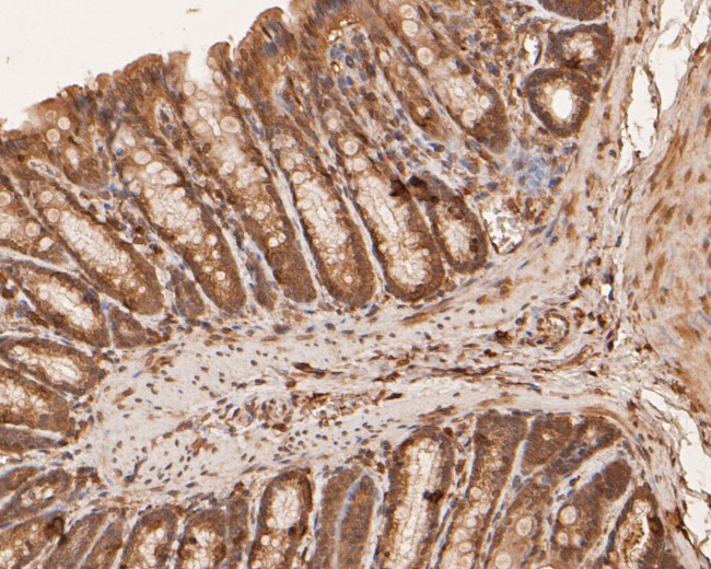 BCL2L15 Antibody in Immunohistochemistry (Paraffin) (IHC (P))