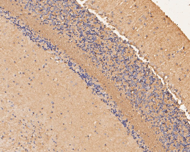 ZACN Antibody in Immunohistochemistry (Paraffin) (IHC (P))