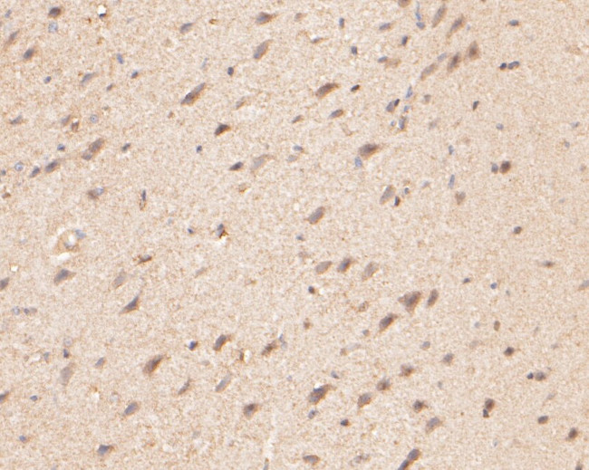 ZACN Antibody in Immunohistochemistry (Paraffin) (IHC (P))