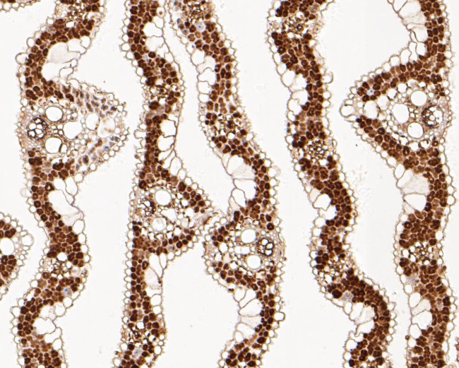 ADT2 Antibody in Immunohistochemistry (Paraffin) (IHC (P))