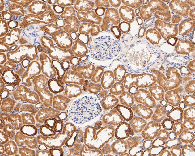 P2X1 Antibody in Immunohistochemistry (Paraffin) (IHC (P))