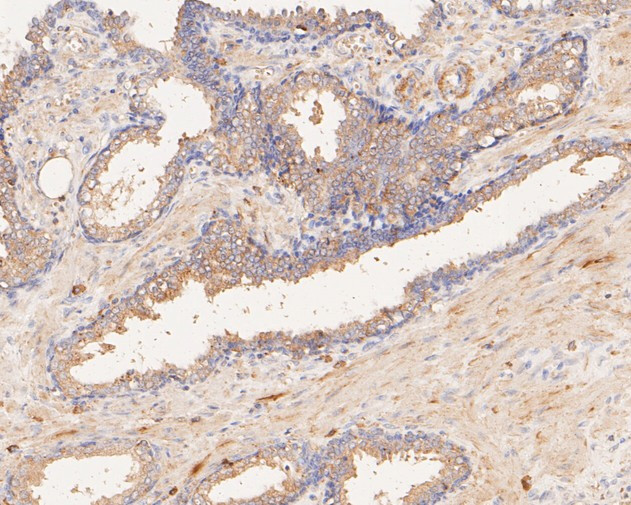 P2X1 Antibody in Immunohistochemistry (Paraffin) (IHC (P))