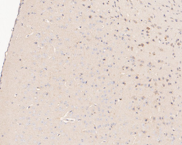 P2X1 Antibody in Immunohistochemistry (Paraffin) (IHC (P))