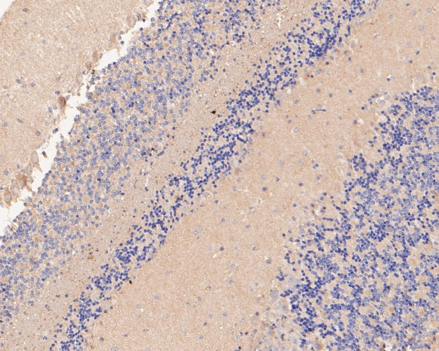 P2X1 Antibody in Immunohistochemistry (Paraffin) (IHC (P))