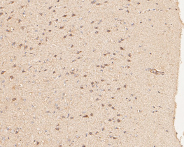 P2X1 Antibody in Immunohistochemistry (Paraffin) (IHC (P))