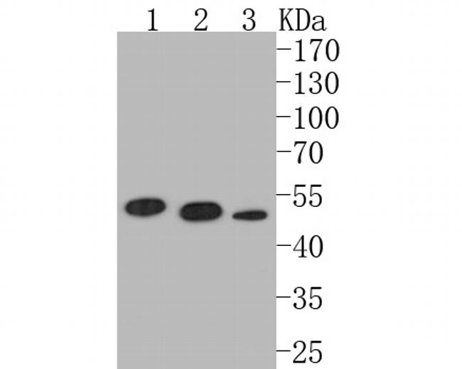 P2X1 Antibody in Western Blot (WB)