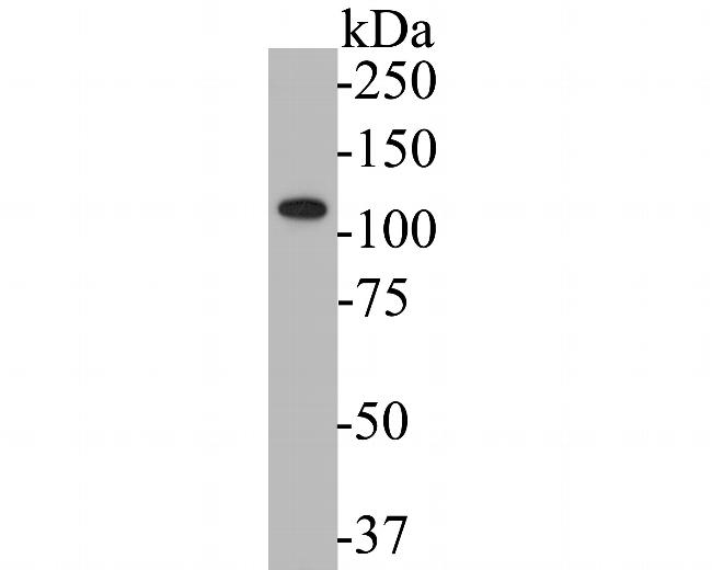 Kv2.2 Antibody in Western Blot (WB)