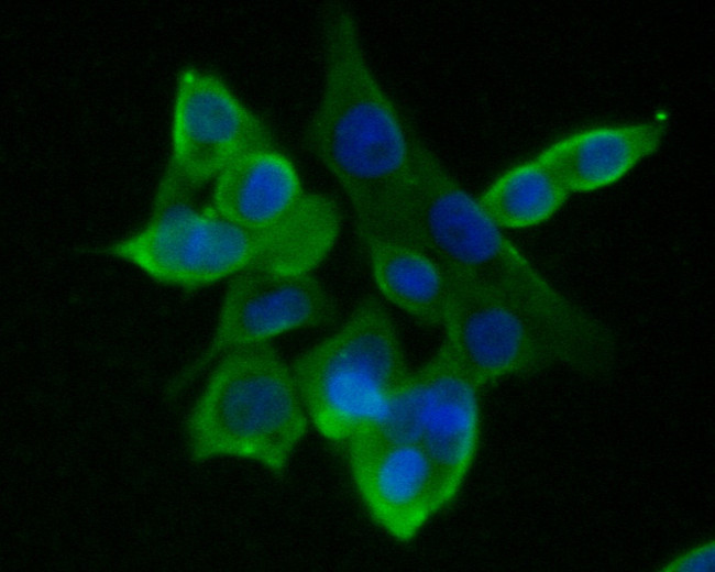 GABRA1 Antibody in Immunocytochemistry (ICC/IF)