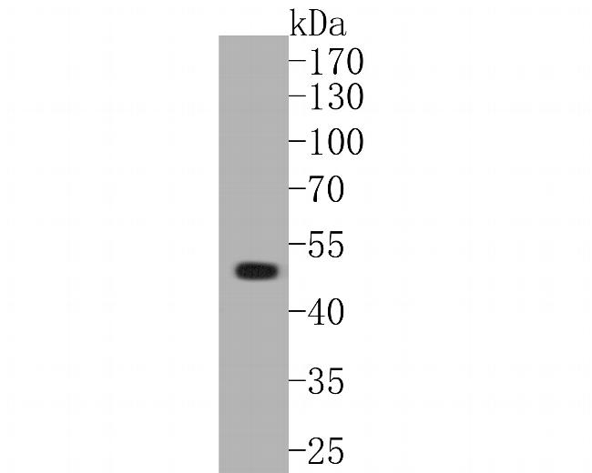 GABRA1 Antibody in Western Blot (WB)