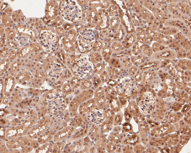 ZHX2 Antibody in Immunohistochemistry (Paraffin) (IHC (P))