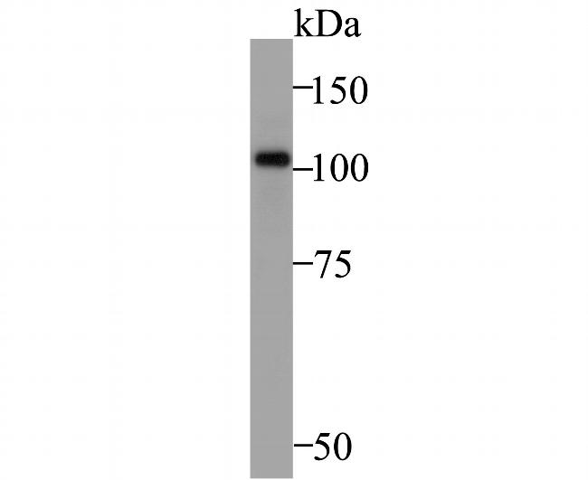 ZHX2 Antibody in Western Blot (WB)