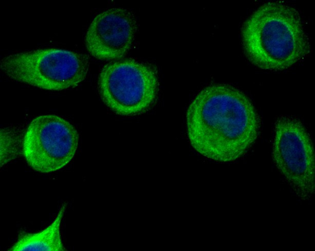 Follistatin Antibody in Immunocytochemistry (ICC/IF)