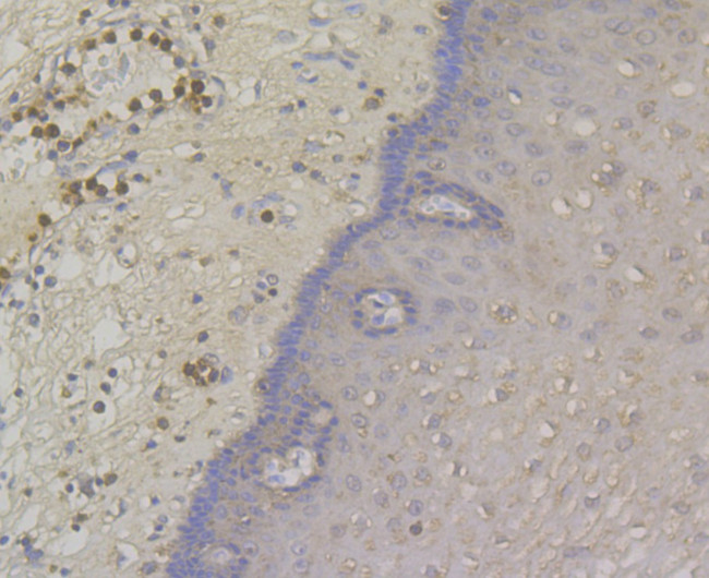 Desmoglein 3 Antibody in Immunohistochemistry (Paraffin) (IHC (P))